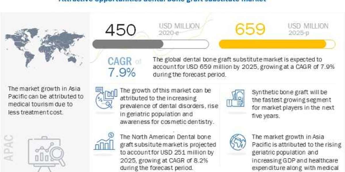 Dental Bone Graft Substitute Market Analysis of Upstream Raw Materials & Downstream Demand