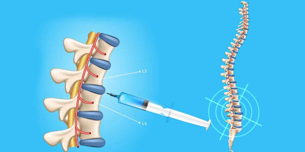 Spinal Needles Market Outlook, Dynamics & Insights 2022-2030