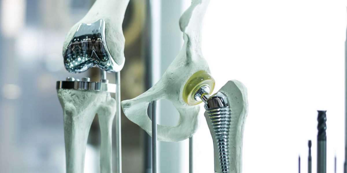 America Orthopedic Biomaterial Market Outlook on Thriving Accruals By 2032; Confirms MRFR