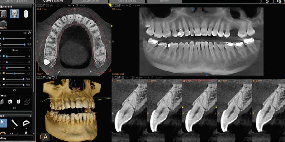 The Global CBCT Dental Imaging Market Outlook Reveals Industry Growth Trends