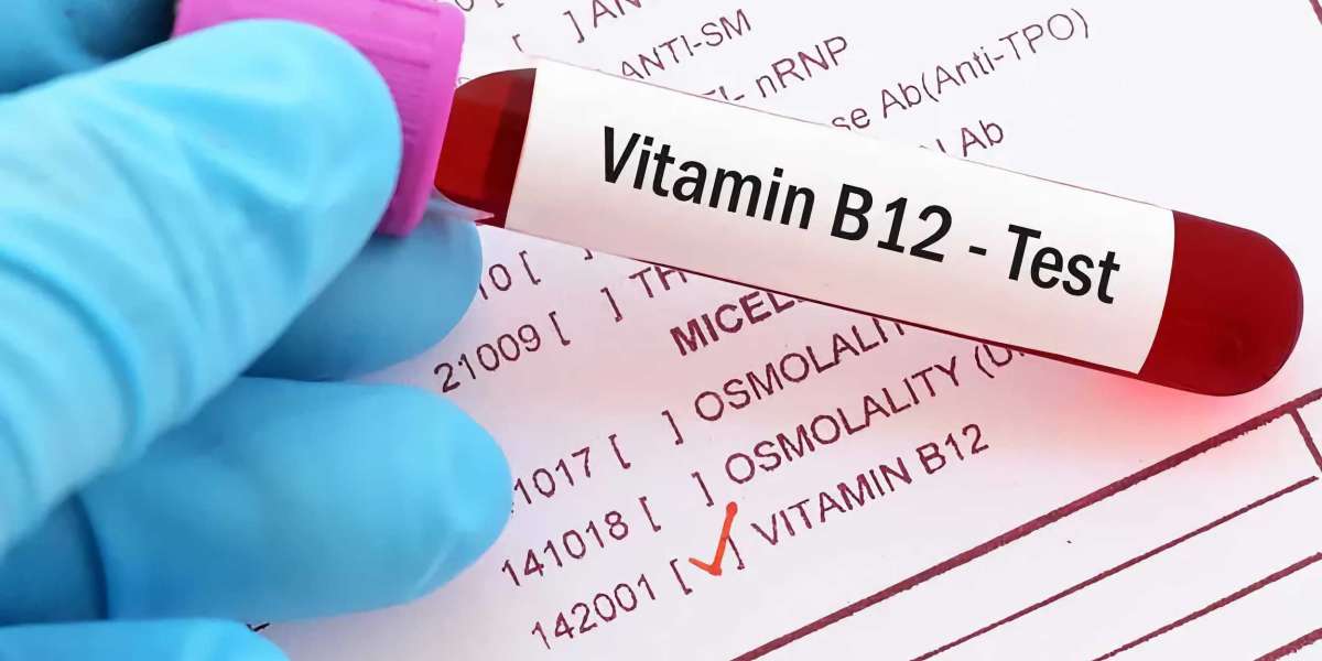 Active B12 Test Market Outlook on Concerns Faced by the Industry