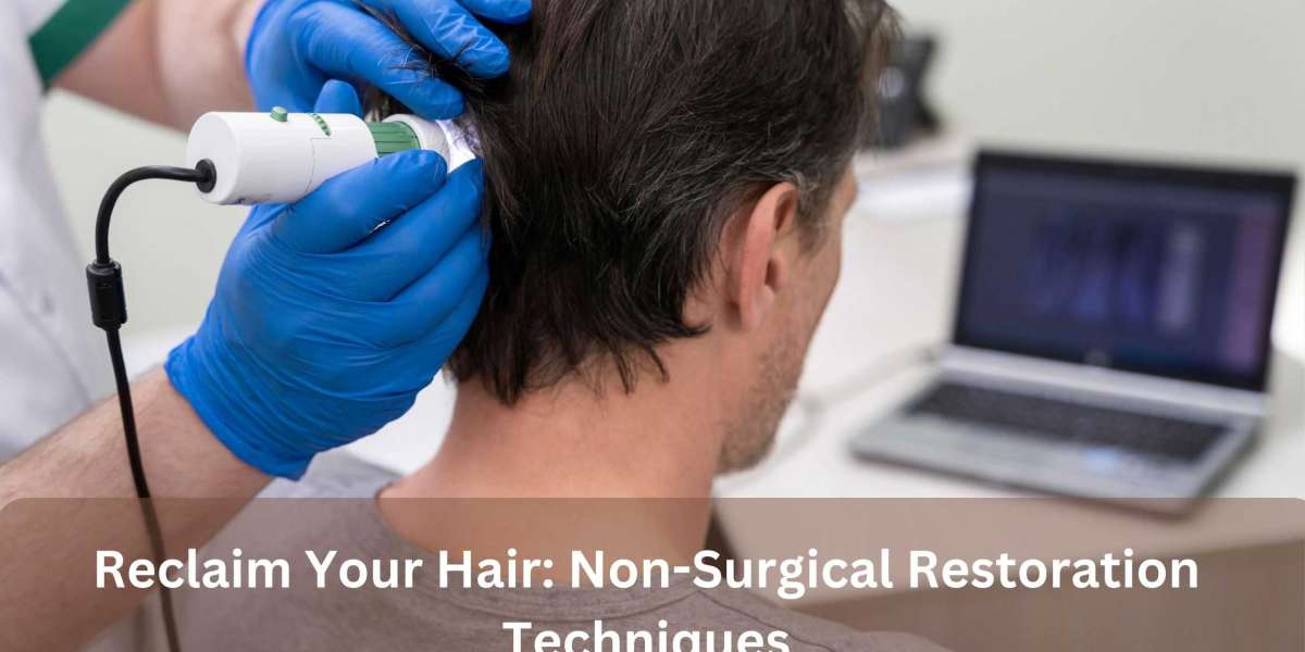 Reclaim Your Hair: Non-Surgical Restoration Techniques