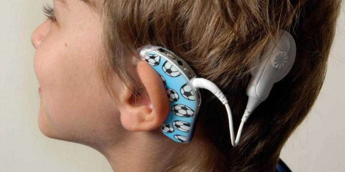 Cochlear Implants Market Trends, Factors and Forecast till 2031
