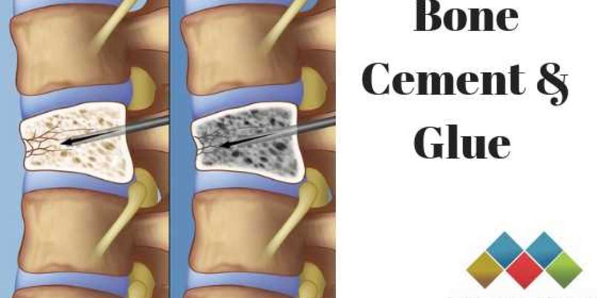 Applications of Bone Cement and Glue Market in Orthopedics