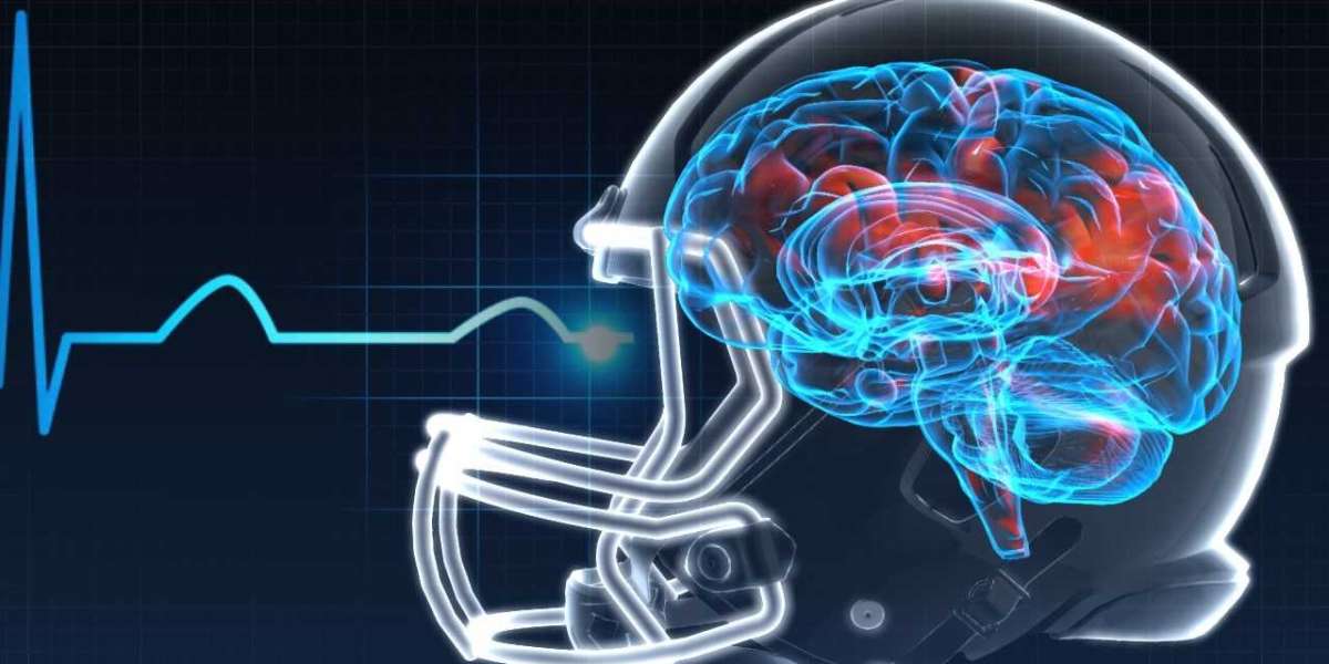 Concussion Market Boom: Investment Insights in Diagnosis & Treatment (2024)