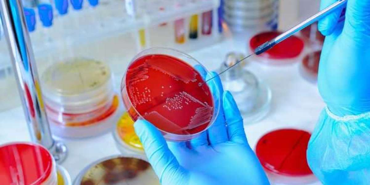 Microbiology Testing Boom: Safeguarding Health & Environment in the Age of NGS