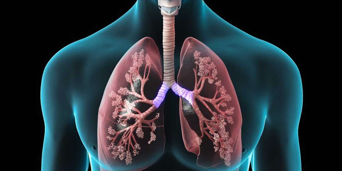 Merck & Co. Unveils Cutting-Edge COPD Inhalers: Transforming Patient Outcomes in Obstructive Lung Disease