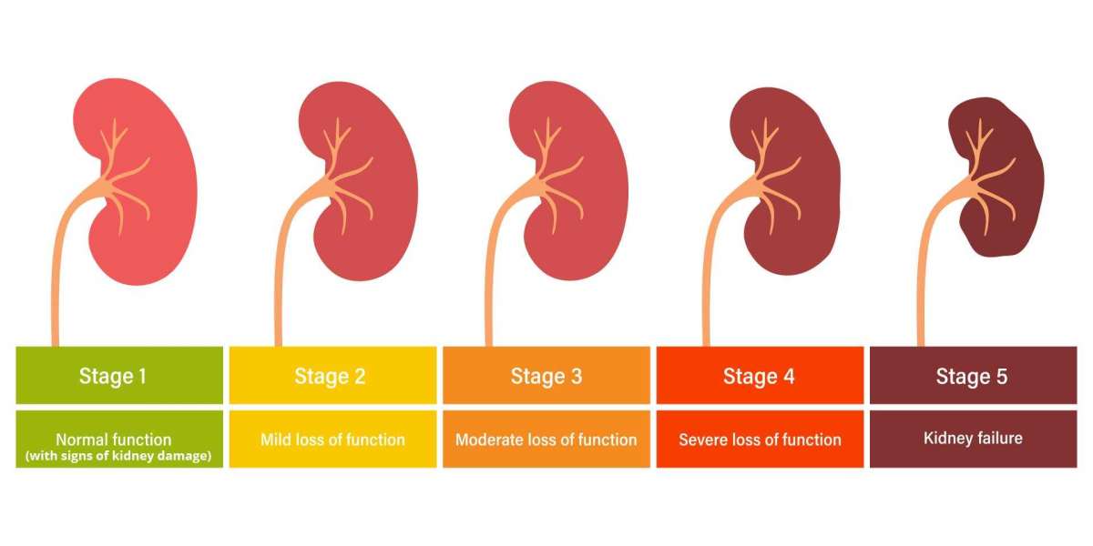 Advancements in CKD Treatment: The Role of SGLT-2 Inhibitors and Long-Acting Medications