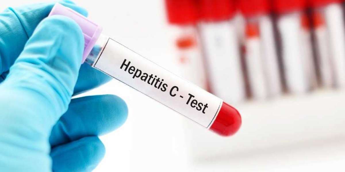 Hepatitis Test Solution Diagnosis Market Forecast: Market Value, CAGR, and Leading Players