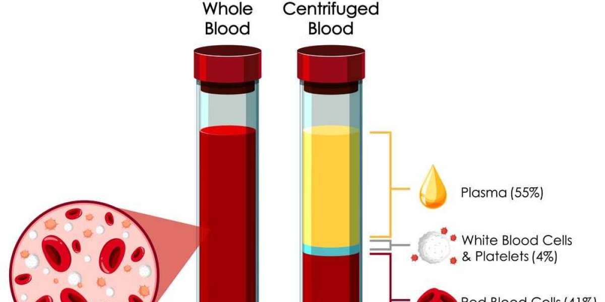 Exploring the Impact of Blood Plasma Derivatives: Innovations by Leading Companies in Albumin, Immunoglobulins, and Clot