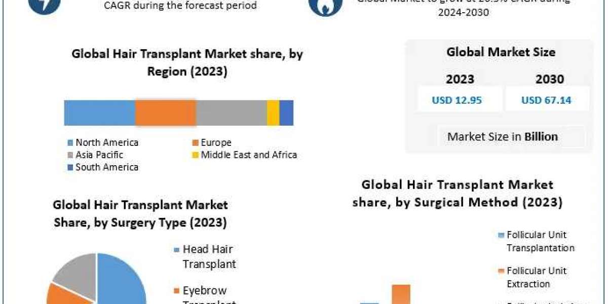 Hair Transplant Market Mastering Trends: Industry Insights, Size, and Potential Growth Paths | 2023-2030