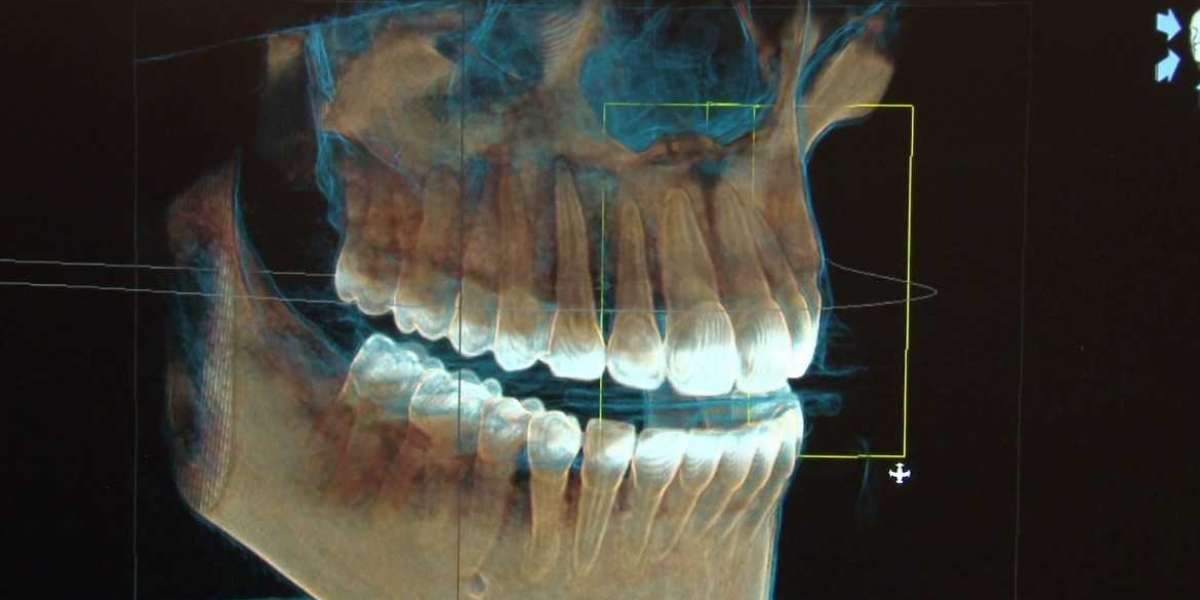 Dental Imaging: Innovations by Dentsply Sirona and Carestream Health in CBCT Technology