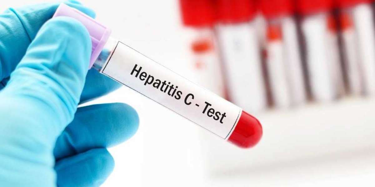 Hepatitis Test Solution Diagnosis Market Analysis: Projected Growth and Key Trends (2022-2030)