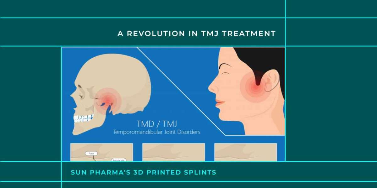 Sun Pharma's 3D Printed Splints: A Revolution in TMJ Treatment