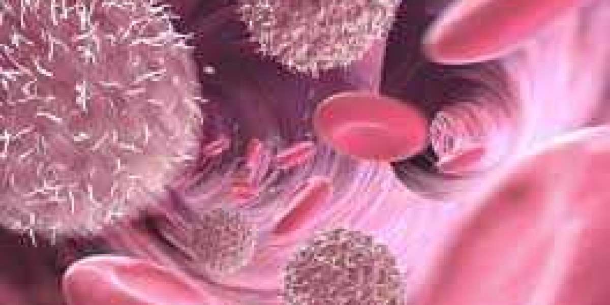 Pirtobrutinib Market Size, Share, Growth Analysis Report 2034