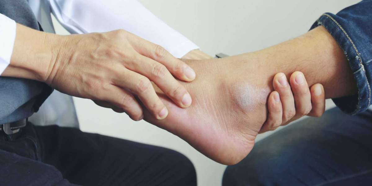 How to Choose the Right Ankle Surgeon Brooklyn NY