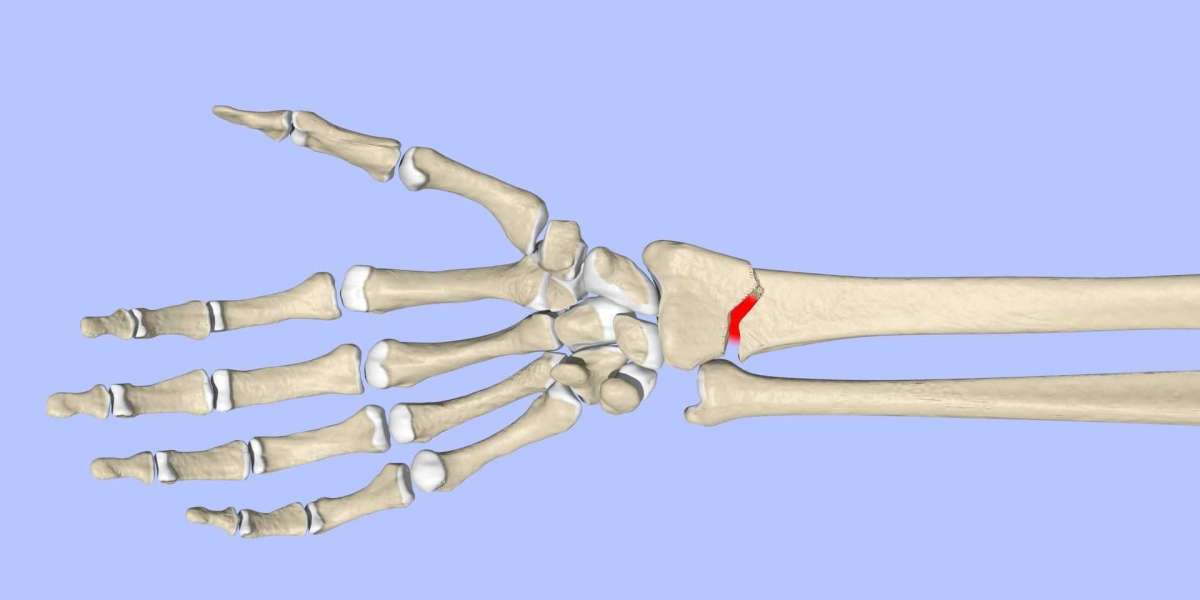 What Are the Risks Associated with Fracture Treatments?