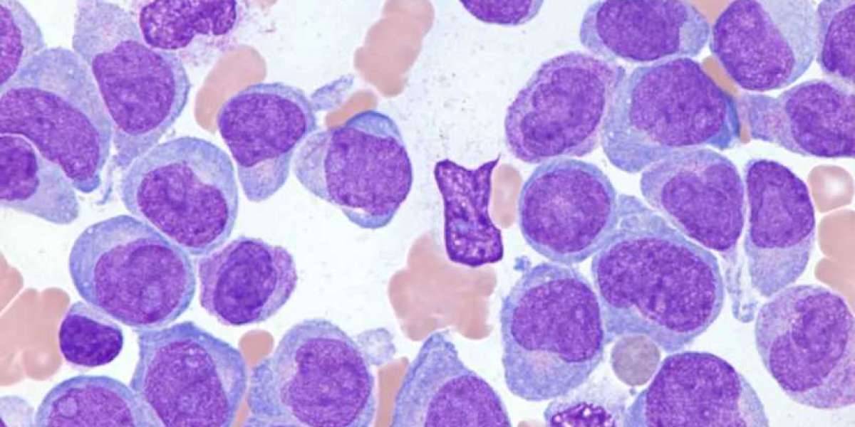 Global Acute Myeloid Leukemia Treatment Market